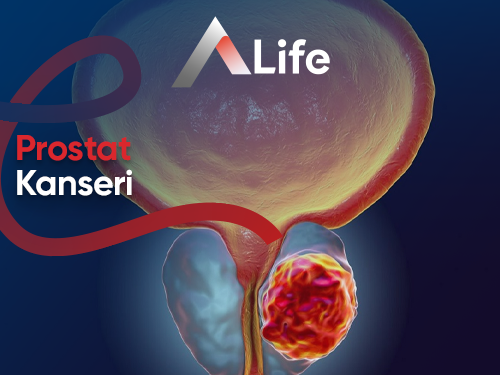 Prostat Kanseri